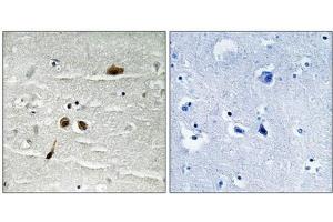 Immunohistochemical analysis of paraffin-embedded human brain tissue using MDC1 (Phospho-Ser513) antibody (left)or the same antibody preincubated with blocking peptide (right). (MDC1 Antikörper  (pSer513))