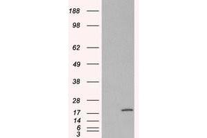Image no. 2 for anti-Ribosomal Protein S19 (RPS19) (Internal Region) antibody (ABIN374632)