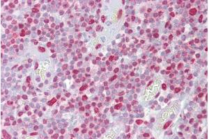 Immunohistochemistry with Tonsil tissue at an antibody concentration of 5µg/ml using anti-H2AFX antibody (ARP58281_P050) (H2AFX Antikörper  (Middle Region))