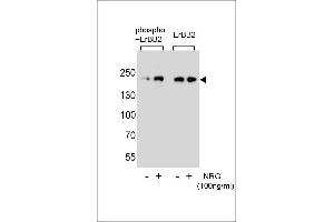 Western blot analysis of extracts from SK-BR-3 cell,untreated or treated with NRG,using phospho-mouse ERBB2-(left) or mouse ERBB2 Antibody (right).