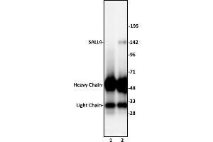 SALL4 antibody (pAb) tested by Immunoprecipitation. (SALL4 Antikörper  (N-Term))