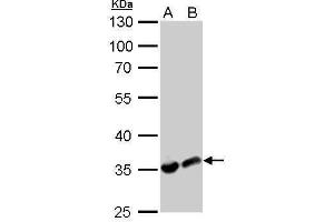 Western Blotting (WB) image for anti-Lactate Dehydrogenase A (LDHA) antibody (ABIN2855034)