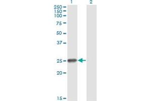 Western Blot analysis of RNF114 expression in transfected 293T cell line by ZNF313 monoclonal antibody (M03), clone S2.