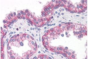 Immunohistochemistry (Formalin-fixed Paraffin-embedded Sections) (IHC (fp)) image for anti-G Protein-Coupled Receptor 32 (GPR32) (AA 1-15) antibody (ABIN604926)