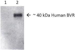 Western blot analysis of Human, Rat Brain cell lysates showing detection of BVR protein using Rabbit Anti-BVR Polyclonal Antibody . (Biliverdin Reductase Antikörper  (HRP))