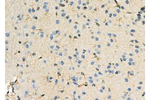 ABIN6263006 and ABIN6274023 at 1/100 staining Mouse brain tissue by IHC-P. (LRP2 Antikörper  (Internal Region))