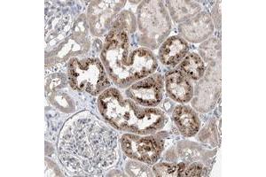 Immunohistochemical staining of human kidney with CEP85L polyclonal antibody  shows strong cytoplasmic positivity in cells of tubules at 1:10-1:20 dilution. (C6orf204 Antikörper)