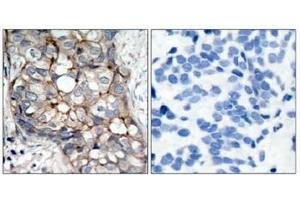 Image no. 3 for anti-Epidermal Growth Factor Receptor (EGFR) (AA 1068-1072) antibody (ABIN197228) (EGFR Antikörper  (AA 1068-1072))