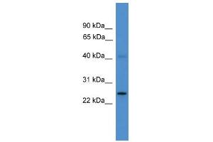 WB Suggested Anti-UCHL1 Antibody Titration: 0. (UCHL1 Antikörper  (C-Term))