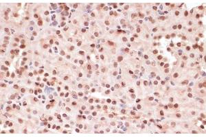 Immunohistochemistry of paraffin-embedded Mouse kidney using Phospho-ATF2(T71) Polyclonal Antibody at dilution of 1:100 (40x lens). (ATF2 Antikörper  (pThr71))