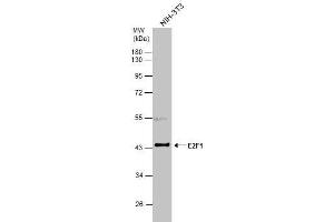 WB Image Whole cell extract (30 μg) was separated by 10% SDS-PAGE, and the membrane was blotted with E2F1 antibody , diluted at 1:3000. (E2F1 Antikörper)