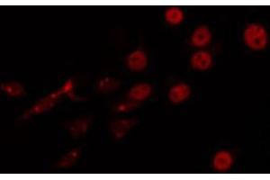ABIN6266747 staining LOVO by IF/ICC. (FOXJ1 Antikörper  (Internal Region))