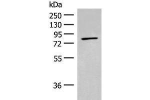 Western blot analysis of Mouse kidney tissue lysate using ADAM21 Polyclonal Antibody at dilution of 1:200 (ADAM21 Antikörper)