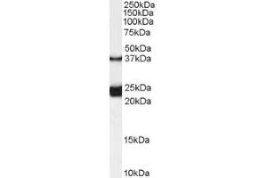 Image no. 1 for anti-Galanin Receptor 1 (GALR1) (Internal Region) antibody (ABIN374858) (Galanin Receptor 1 Antikörper  (Internal Region))