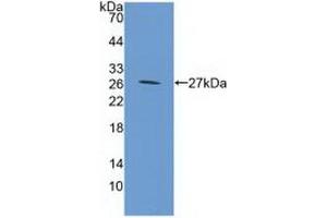 Western blot analysis of recombinant Mouse GP39. (CHI3L1 Antikörper  (AA 112-356))