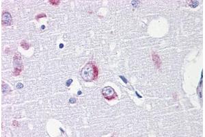 Human Brain, cortex: Formalin-Fixed, Paraffin-Embedded (FFPE) (DARS Antikörper  (AA 393-501))