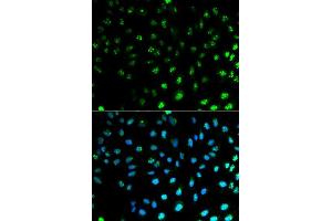 Immunofluorescence analysis of MCF7 cell using S100A8 antibody. (S100A8 Antikörper  (AA 1-93))