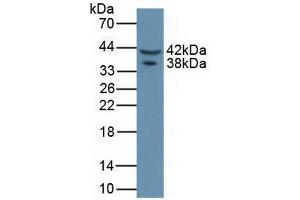 Figure. (Asporin Antikörper  (AA 16-373))