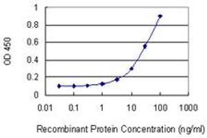 Detection limit for recombinant GST tagged ACD is 1 ng/ml as a capture antibody. (ACD Antikörper  (AA 1-544))