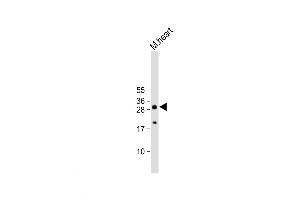 Western Blot at 1:2000 dilution + M. (AQP11 Antikörper  (C-Term))