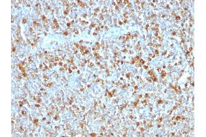 Formalin-fixed, paraffin-embedded human Tonsil stained with Alpha-1-Antitrypsin Mouse Monoclonal Antibody (AAT/1379). (SERPINA1 Antikörper)