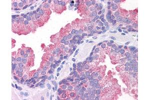 Anti-TMEM184A antibody IHC of human prostate. (TMEM184A Antikörper  (C-Term))