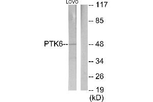 Western blot analysis of extracts from LOVO cells, using Breast Tumor Kinase antibody. (PTK6 Antikörper)