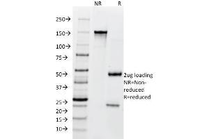 SDS-PAGE Analysis Purified BCL10 Mouse Monoclonal Antibody (SPM520). (BCL10 Antikörper  (AA 122-168))