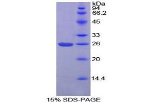SDS-PAGE analysis of Mouse PICK1 Protein.