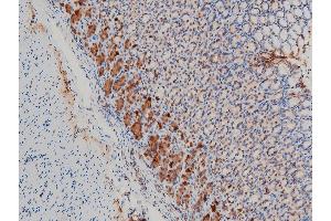 Immunohistochemistry (IHC) image for anti-LIM Domain Kinase 1 (LIMK1) (pThr508) antibody (ABIN6255701)