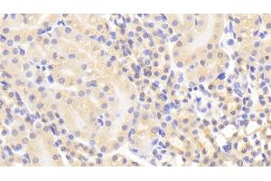 Detection of MMP1 in Mouse Kidney Tissue using Polyclonal Antibody to Matrix Metalloproteinase 1 (MMP1)