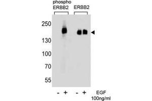 Western blot analysis of extracts from A431 cells, untreated or treated with EGF (100ng/ml), using phos-ERBB2 antibody (left) or nonphos Ab (right) (ErbB2/Her2 Antikörper  (pTyr1127))