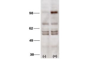 Western Blotting (WB) image for anti-Phosphoinositide-3-Kinase, Class 3 (PIK3C3) antibody (ABIN3000296)