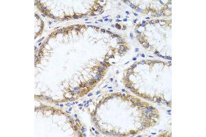 Immunohistochemistry of paraffin-embedded human stomach using GPM6A antibody at dilution of 1:100 (x40 lens). (GPM6A Antikörper)