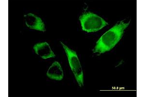 Immunofluorescence of monoclonal antibody to SPATA2 on HeLa cell. (SPATA2 Antikörper  (AA 422-519))