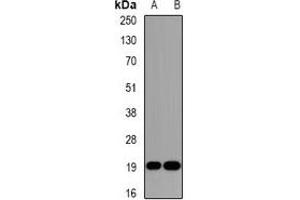 Western blot analysis of DR1 expression in Jurkat (A), HepG2 (B) whole cell lysates. (DR1 Antikörper)