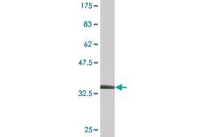 Western Blotting (WB) image for anti-Vitamin K-dependent protein C (PROC) (AA 32-131) antibody (ABIN562448)