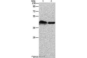 Western blot analysis of Mouse bladder tissue and 293T cell, using CRELD1 Polyclonal Antibody at dilution of 1:930 (CRELD1 Antikörper)