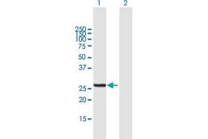 Western Blot analysis of MTX2 expression in transfected 293T cell line by MTX2 MaxPab polyclonal antibody.