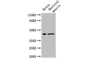Western Blot Positive WB detected in: Mouse brain tissue, Mouse skeletal muscle tissue All lanes: FAM43A antibody at 3 μg/mL Secondary Goat polyclonal to rabbit IgG at 1/50000 dilution Predicted band size: 46 kDa Observed band size: 46 kDa (FAM43A Antikörper  (AA 1-200))