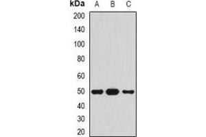 Western blot analysis of Serpin A4 expression in HepG2 (A), mouse pancreas (B), rat pancreas (C) whole cell lysates. (SERPINA4 Antikörper)