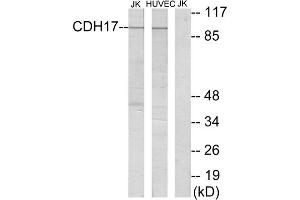 Western blot analysis of extracts from Jurkat cells and HUVEC cells, using CDH17 antibody. (LI Cadherin Antikörper  (Internal Region))