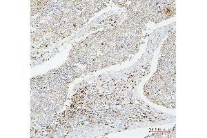 IHC analysis of CD43 using anti-CD43 antibody (ABIN7601042). (CD43 Antikörper  (AA 272-400))
