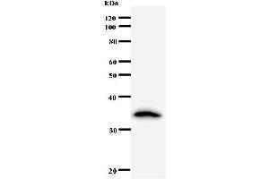 Western Blotting (WB) image for anti-Crooked Neck Pre-mRNA Splicing Factor-Like 1 (CRNKL1) antibody (ABIN931026) (CRNKL1 Antikörper)