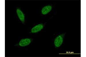 Immunofluorescence of purified MaxPab antibody to RNF20 on HeLa cell.