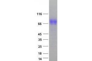 Validation with Western Blot (TYR Protein (Myc-DYKDDDDK Tag))
