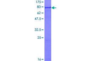 Image no. 2 for Calcium/calmodulin-Dependent Protein Kinase II beta (CAMK2B) (AA 1-503) protein (GST tag) (ABIN1347929)