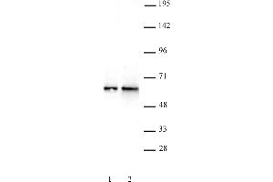 DMAP1 antibody (pAb) tested by Western blot. (DMAP1 Antikörper  (C-Term))