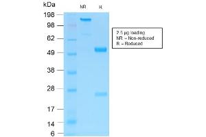 SDS-PAGE Analysis of Purified NGFR Rabbit Recombinant Monoclonal Antibody ABIN6383799. (Rekombinanter NGFR Antikörper)