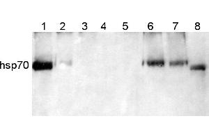Image no. 1 for anti-Heat Shock Protein 70 (HSP70) (Cytoplasmic) antibody (ABIN334584) (HSP70 Antikörper  (Cytoplasmic))